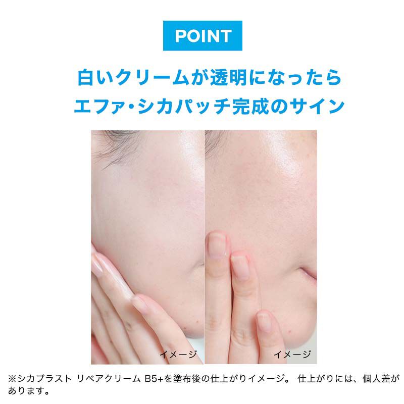 POINT 白いクリームが透明になったら エファ・シカパッチ完成のサイン イメージ イメージ ※シカプラスト リペアクリーム B5+を塗布後の仕上がりイメージ。仕上がりには、個人差があります。