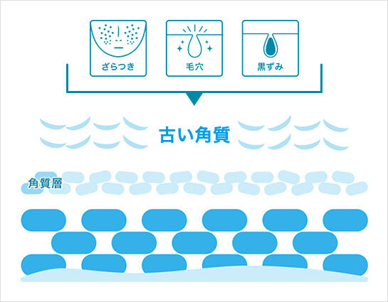 ざらつき 毛穴 黒ずみ 古い角質 角質層