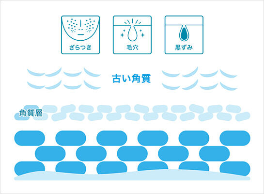 ざらつき 毛穴 黒ずみ 古い角質 角質層