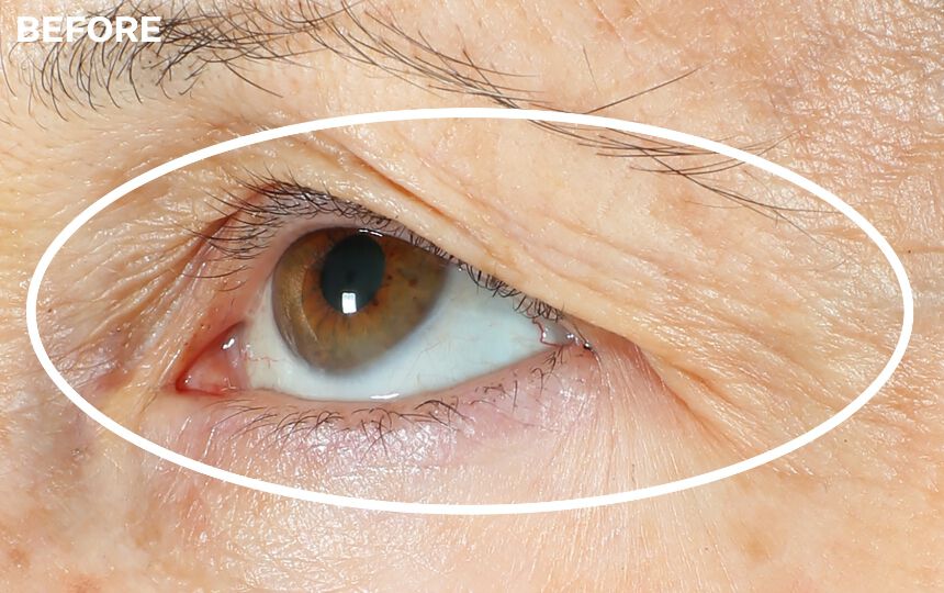 *Unretouched photos. Individual results will vary.