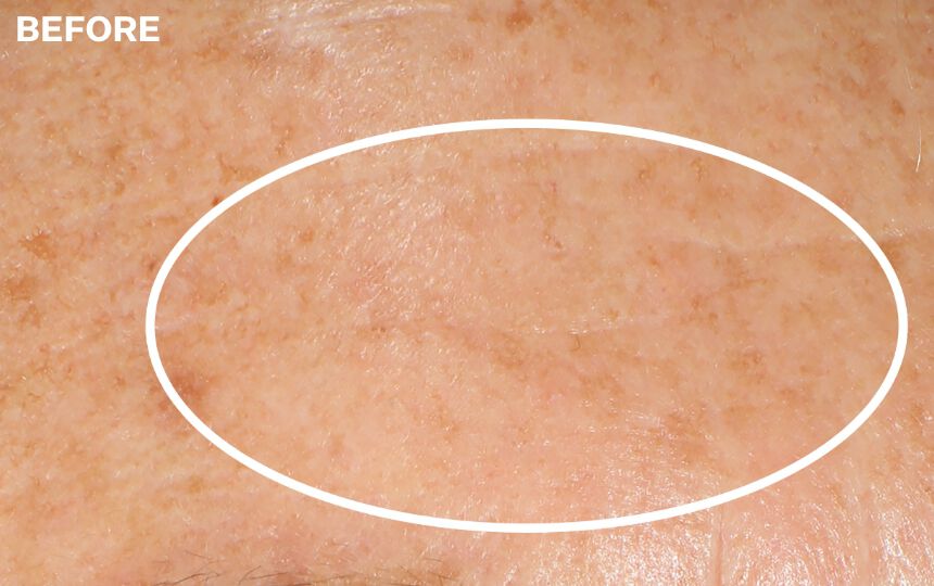 Results after 4 weeks when used as directed. Individual results will vary.