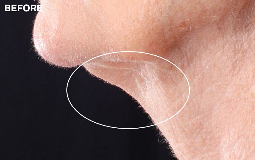 *Results after four weeks when used as directed. Unretouched images. Individual results will vary.
