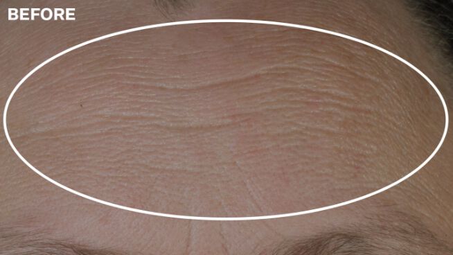 *Results after four weeks when used as directed. Unretouched images. Individual results will vary.